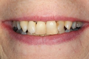 Before Treatment image